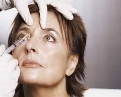 Rajeunir son regard avec la chirurgie esthétique des paupières