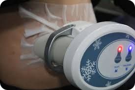 Lutter contre la cellulite avec la Cryolipolyse